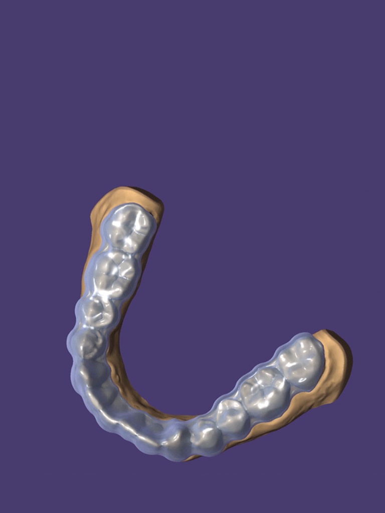 DentalCAD - Ultimate Lab Bundle Flex