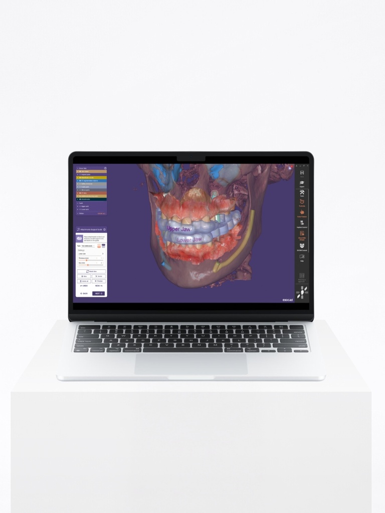 exoplan Core Version