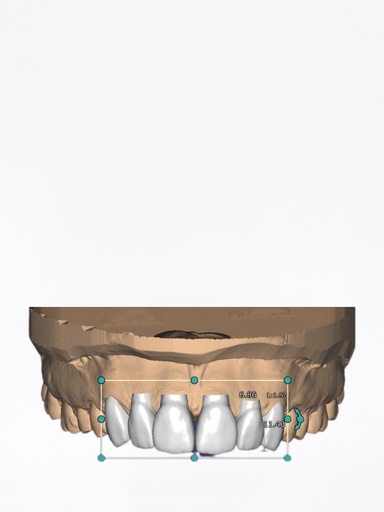 DentalCAD - Modulo Smile Creator con TruSmile Stand Alone